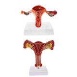 Maxbell Maxbell 1:1 Human Female Uterus Ovary Pathological +Normal Model Anatomical Study