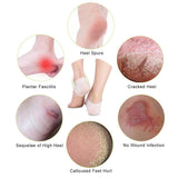 Maxbell 2 Pairs of Silicone Moisturising Gel Heel Cracked Foot Care Protectors Socks