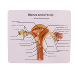 Maxbell Maxbell 1:1 Human Female Uterus Ovary Pathological +Normal Model Anatomical Study