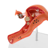 Maxbell Maxbell 1:1 Human Female Uterus Ovary Pathological +Normal Model Anatomical Study