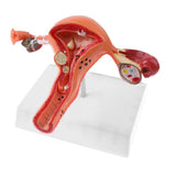 Maxbell Maxbell 1:1 Human Female Uterus Ovary Pathological +Normal Model Anatomical Study