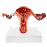 Maxbell Maxbell 1:1 Human Female Uterus Ovary Pathological +Normal Model Anatomical Study