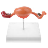 Maxbell Maxbell 1:1 Human Female Uterus Ovary Pathological +Normal Model Anatomical Study