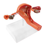 Maxbell Maxbell 1:1 Human Female Uterus Ovary Pathological +Normal Model Anatomical Study