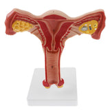 Maxbell Maxbell 1:1 Human Female Uterus Ovary Pathological +Normal Model Anatomical Study