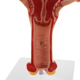 Maxbell Maxbell 1:1 Human Female Uterus Ovary Pathological +Normal Model Anatomical Study