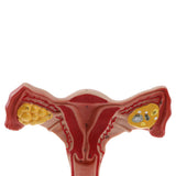 Maxbell Maxbell 1:1 Human Female Uterus Ovary Pathological +Normal Model Anatomical Study