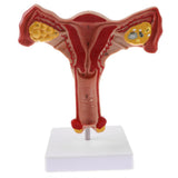 Maxbell Maxbell 1:1 Human Female Uterus Ovary Pathological +Normal Model Anatomical Study