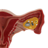 Maxbell Maxbell 1:1 Human Female Uterus Ovary Pathological +Normal Model Anatomical Study