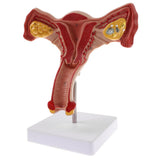 Maxbell Maxbell 1:1 Human Female Uterus Ovary Pathological +Normal Model Anatomical Study