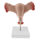 Maxbell Maxbell 1:1 Human Female Uterus Ovary Pathological +Normal Model Anatomical Study