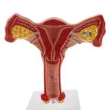 Maxbell Maxbell 1:1 Human Female Uterus Ovary Pathological +Normal Model Anatomical Study