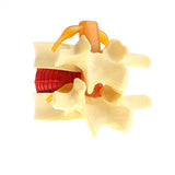 Maxbell 3X Human Spine Lumbar Intervertebral Disc Protrusion Model Magnification 2x