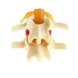 Maxbell 3X Human Spine Lumbar Intervertebral Disc Protrusion Model Magnification 2x