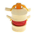 Maxbell 3X Human Spine Lumbar Intervertebral Disc Protrusion Model Magnification 2x