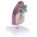 Maxbell Maxbell 2:3 Human Diseased Lung Structure Respiratory System Pathological Model Kits Lab Supplies School Teaching Display