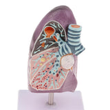 Maxbell Maxbell 2:3 Human Diseased Lung Structure Respiratory System Pathological Model Kits Lab Supplies School Teaching Display