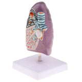 Maxbell Maxbell 2:3 Human Diseased Lung Structure Respiratory System Pathological Model Kits Lab Supplies School Teaching Display