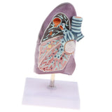 Maxbell Maxbell 2:3 Human Diseased Lung Structure Respiratory System Pathological Model Kits Lab Supplies School Teaching Display
