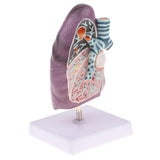 Maxbell Maxbell 2:3 Human Diseased Lung Structure Respiratory System Pathological Model Kits Lab Supplies School Teaching Display