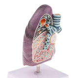 Maxbell Maxbell 2:3 Human Diseased Lung Structure Respiratory System Pathological Model Kits Lab Supplies School Teaching Display