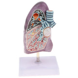 Maxbell Maxbell 2:3 Human Diseased Lung Structure Respiratory System Pathological Model Kits Lab Supplies School Teaching Display
