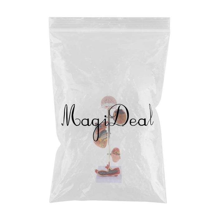 Maxbell Removable 5 Parts Hypertension Brain Eye Heart ney Artery Diseased Model Kits Lab Demonstration School Display - Aladdin Shoppers