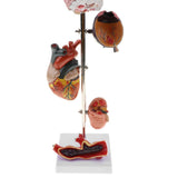 Maxbell Removable 5 Parts Hypertension Brain Eye Heart ney Artery Diseased Model Kits Lab Demonstration School Display - Aladdin Shoppers