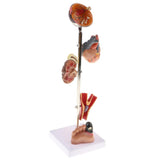 Maxbell Removable 5 Parts Pathological Diabetes 5 Parts (Eye ball, Heart, ney, Vessel, Foot) Model School Teaching Display - Aladdin Shoppers