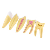 Maxbell Maxbell 12x Enlarged Anatomical Human Teeth Tooth Model, Set of 3 Different Models