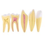 Maxbell Maxbell 12x Enlarged Anatomical Human Teeth Tooth Model, Set of 3 Different Models