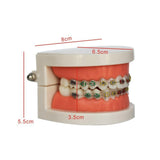 Maxbell Sumulation Teeth Model with Metal Brace for Teacher Classroom Kids Teaching