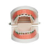 Maxbell Sumulation Teeth Model with Metal Brace for Teacher Classroom Kids Teaching