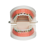 Maxbell Sumulation Teeth Model with Metal Brace for Teacher Classroom Kids Teaching