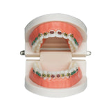 Maxbell Sumulation Teeth Model with Metal Brace for Teacher Classroom Kids Teaching