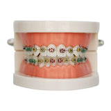 Maxbell Sumulation Teeth Model with Metal Brace for Teacher Classroom Kids Teaching