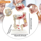 Maxbell Human Colon Model Realistic Colon Pathology Model for Lab Training Classroom
