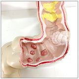 Maxbell Human Colon Model Realistic Colon Pathology Model for Lab Training Classroom
