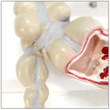 Maxbell Human Colon Model Realistic Colon Pathology Model for Lab Training Classroom