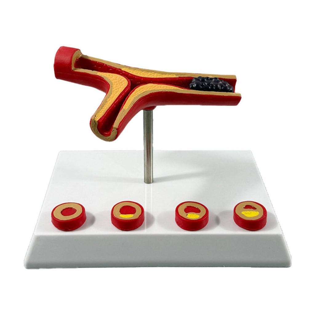 ⚡️Buy Maxbell Human Vessel Model Realistic Cardiovascular Model for ...