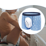 Maxbell Circumcision Underwear for Kids Cotton Easy to Use Foreskin Cut Boxer Briefs 160 Size