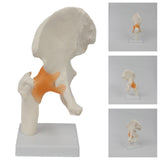 Maxbell Ligament Hip Joint Model Sturdy Teaching Aids for Office School Bone Doctors