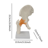 Maxbell Ligament Hip Joint Model Sturdy Teaching Aids for Office School Bone Doctors