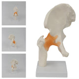 Maxbell Ligament Hip Joint Model Sturdy Teaching Aids for Office School Bone Doctors