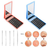 Maxbell Maxbell 5Pieces Blackhead Remover Acne Blemish Needle Pimple Extractor + Mirror Pink