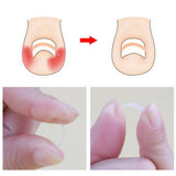 Maxbell Maxbell 10x 3.5mm Ingrown Toenail Straightening Clip Sticker Curved Brace Correction