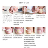 Maxbell Maxbell 10Pieces Ingrown Onyxis Toe Nail Correction Recover Pedicure Orthotic Tool