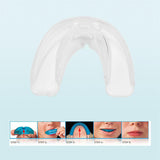 Maxbell Maxbell Silicone Tooth Orthodontic Appliance Trainer Alignment Denta Braces  White