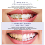 Maxbell Maxbell 1 Pcs Teeth Whitening Pen Whitener Cleaning Bleaching Stains Remover
