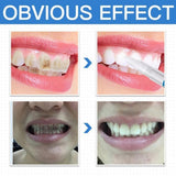 Maxbell Maxbell 1 Pcs Teeth Whitening Pen Whitener Cleaning Bleaching Stains Remover